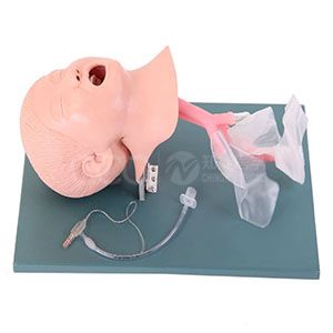 Передовая модель интубации дыхательных путей у детей