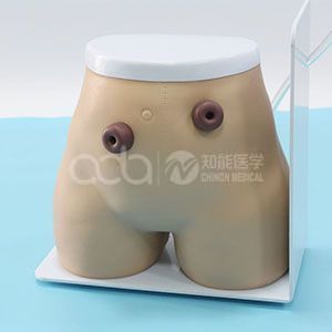 Модель ухода за пациентами с остеомией