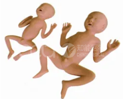 Модель недоношенного ребенка в 30 недель