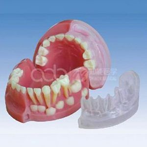 Модель, в которой молочные и постоянные зубы у трехлетних детей чередуются