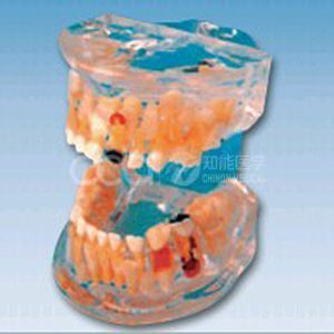 Прозрачная модель патологии молочных зубов