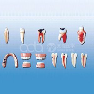 Модель серии повреждений зубов