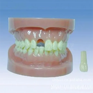 Удаляемая и безкорневая стандартная модель зуба