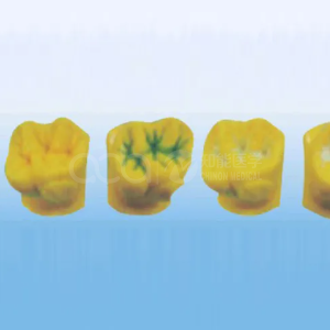 Демонстрационная модель герметизации зубных карманов и фиссур