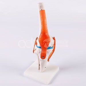 Яркая модель искусственного коленного сустава в натуральном размере