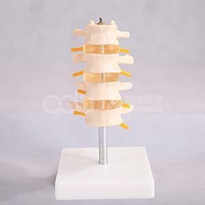 Нормальная комбинация поясничных позвонков (четыре отдела)