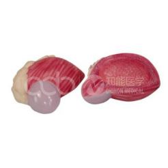 Модель увеличения мочевого пузыря