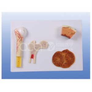 Модель увеличения структуры костей