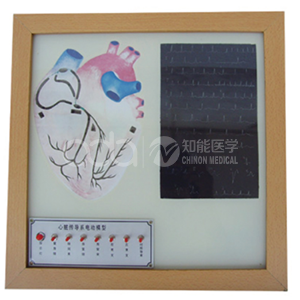 Электрическая модель сердечной системы проводимости